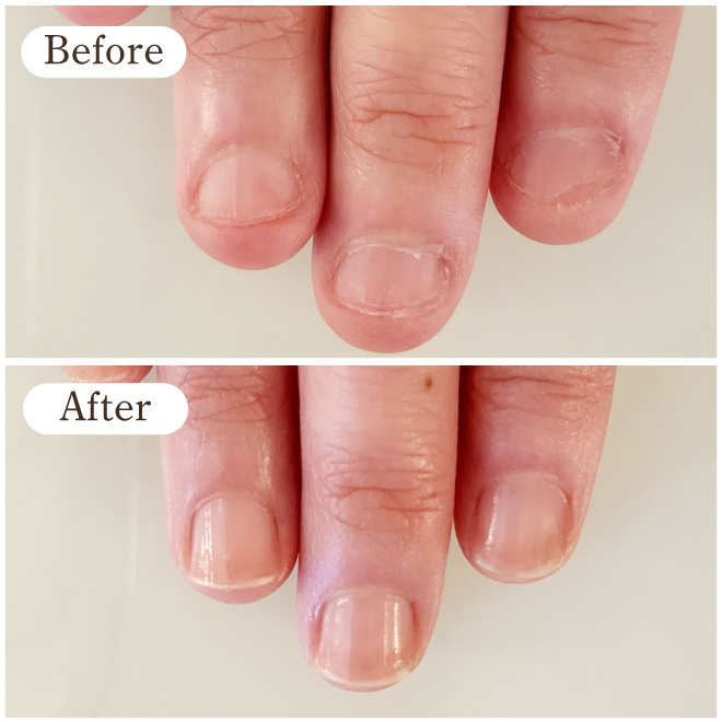 都島ネイルサロン|美爪育成ネイルケアサロンならmaeda